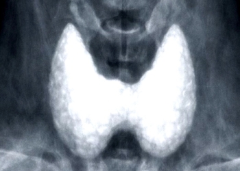 Tumore della tiroide, incontro pubblico a Golfo Aranci con l’Associazione Sole